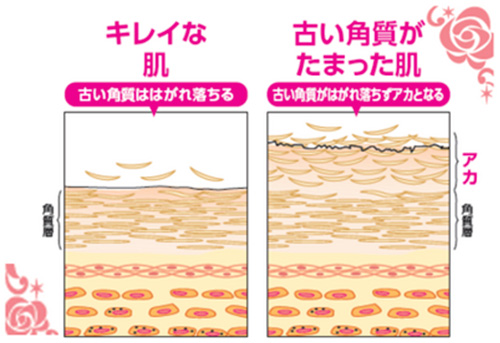 古い角質とは？